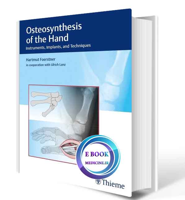 دانلود کتاب steosynthesis of the Hand: Instruments, Implants, and Techniques 2017  (ORIGINAL PDF)